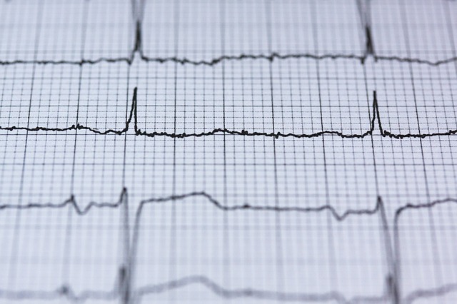 měření ekg